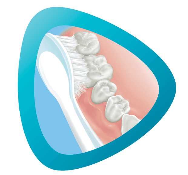Cleaning of interior surfaces of the teeth