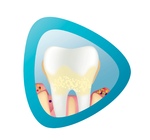 advanced gum problems icon