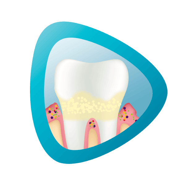 gum problems icon