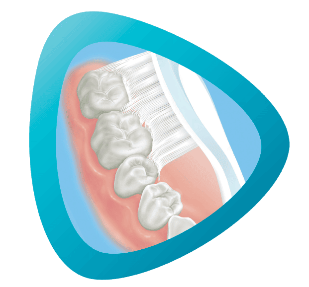 Cleaning of external surfaces of your teeth