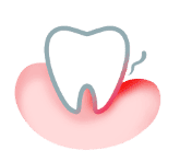 advanced gum problems tooth